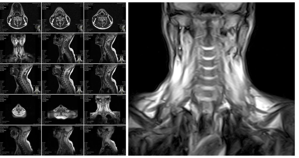 MRI results reading